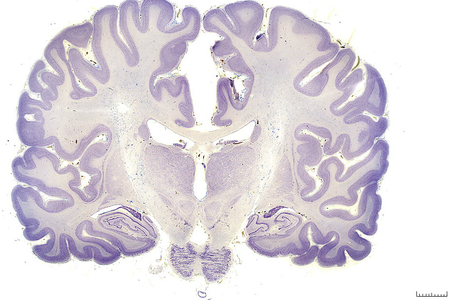 Human brain cortex