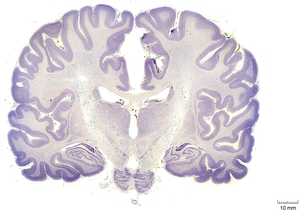 Human brain cortex