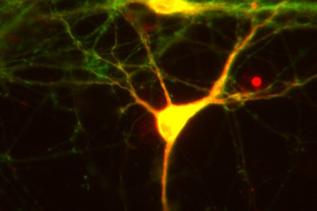 Neuron